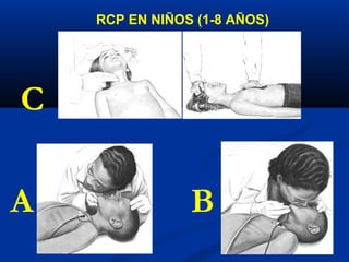 RCP EN NIÑOS (1-8 AÑOS)




C

A               B
 