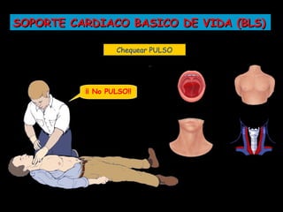 SOPORTE CARDIACO BASICO DE VIDA (BLS)

                  Chequear PULSO




          ¡¡ No PULSO!!
 