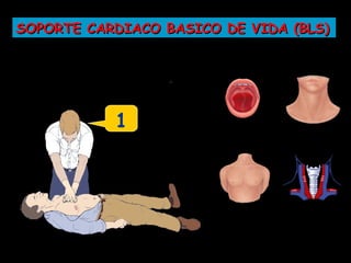 SOPORTE CARDIACO BASICO DE VIDA (BLS)




             Iniciar
           1
           Compresiones
 