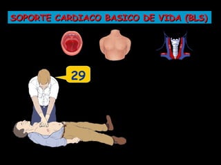 SOPORTE CARDIACO BASICO DE VIDA (BLS)




           29
 