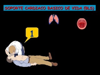 SOPORTE CARDIACO BASICO DE VIDA (BLS)




          1
 