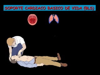 SOPORTE CARDIACO BASICO DE VIDA (BLS)
 