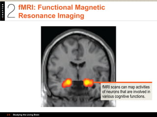 fMRI: Functional Magnetic
Resonance Imaging
2.5 Studying the Living Brain
fMRI scans can map activities
of neurons that are involved in
various cognitive functions.
 