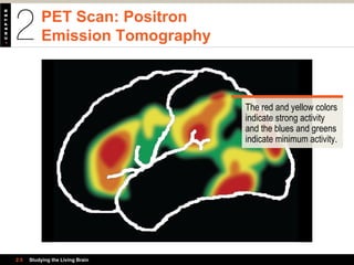 PET Scan: Positron
Emission Tomography
2.5 Studying the Living Brain
The red and yellow colors
indicate strong activity
and the blues and greens
indicate minimum activity.
 