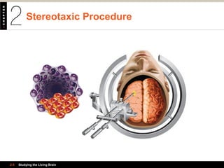 Stereotaxic Procedure
2.5 Studying the Living Brain
 