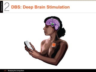 DBS: Deep Brain Stimulation
2.5 Studying the Living Brain
 