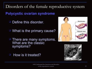 Functions and Disorders of the Reproductive System | PPT