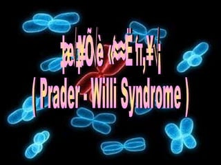 เพรเดอร์ - วิลลี่ ซินโดรม  ( Prader - Willi Syndrome ) 