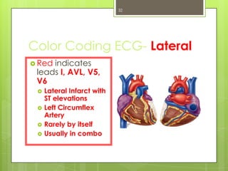 ECG | PPTX