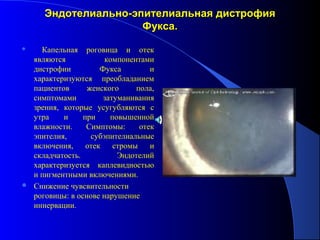 Эндотелиально-эпителиальная дистрофия
                      Фукса.
   Капельная роговица и отек
  являются            компонентами
  дистрофии          Фукса         и
  характеризуются преобладанием
  пациентов      женского      пола,
  симптомами          затуманивания
  зрения, которые усугубляются с
  утра    и     при     повышенной
  влажности.     Симптомы:      отек
  эпителия,       субэпителиальные
  включения,     отек    стромы    и
  складчатость.           Эндотелий
  характеризуется каплевидностью
  и пигментными включениями.
 Снижение чувсвительности
  роговицы: в основе нарушение
  иннервации.
 
