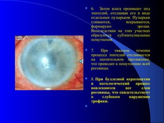    6. Затем влага проникает под
    эпителий, отслаивая его в виде
    отдельных пузырьков. Пузырьки
    сливаются,        вскрываются,
    формируют               эрозии.
    Впоследствии на этих участках
    образуются субэпителиальные
    помутнения.

   7.   При    тяжелом    течении
    процесса эпителий отслаивается
    на значительном протяжении,
    что приводит к помутнению всей
    роговицы.

   8. При буллезной кератопатии
    в патологический процесс
    вовлекаются      все     слои
    роговицы, что свидетельствует
    о     глубоком     нарушении
    трофики.

 