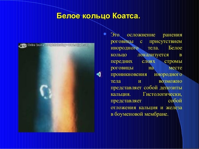 Болит желчный пузырь симптомы лечение