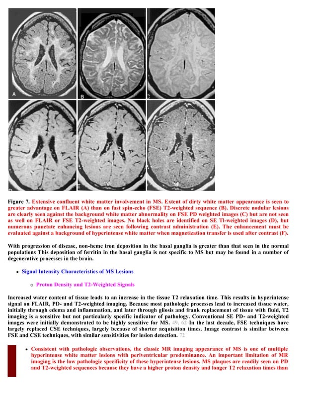 Case record... Multiple sclerosis