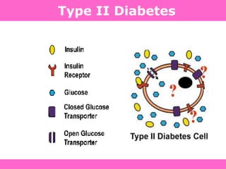Type II Diabetes
 