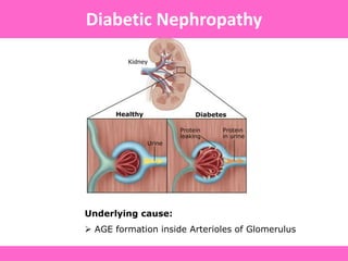Underlying cause:
 AGE formation inside Arterioles of Glomerulus
Diabetic Nephropathy
 