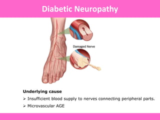 Underlying cause
 Insufficient blood supply to nerves connecting peripheral parts.
 Microvascular AGE
Diabetic Neuropathy
 
