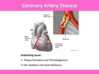 Underlying cause:
 Plaque formation and Thrombogenesis.
 LDL oxidation and Lipid imbalance
Coronary Artery Disease
 