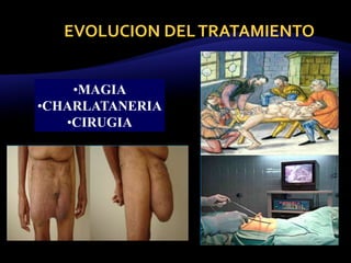 EVOLUCION DELTRATAMIENTO
•MAGIA
•CHARLATANERIA
•CIRUGIA
 