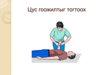 Цус гоожилтыг тогтоох

 