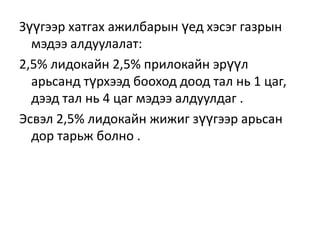 Зүүгээр хатгах ажилбарын үед хэсэг газрын
мэдээ алдуулалат:
2,5% лидокайн 2,5% прилокайн эрүүл
арьсанд түрхээд бооход доод тал нь 1 цаг,
дээд тал нь 4 цаг мэдээ алдуулдаг .
Эсвэл 2,5% лидокайн жижиг зүүгээр арьсан
дор тарьж болно .

 