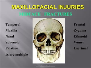 MAXILLOFACIAL INJURIES
MIDFACE FRACTURES
Temporal

Frontal

Maxilla

Zygoma

Nasal

Ethmoid

Sphenoid

Vomer

Palatine

Lacrimal

#s are multiple
www.indiandenalacademy.com

 