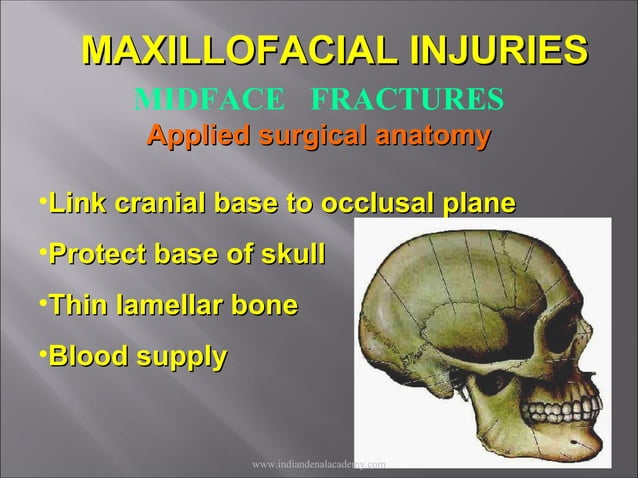 Mid face fractures / /certified fixed orthodontic courses by Indian ...