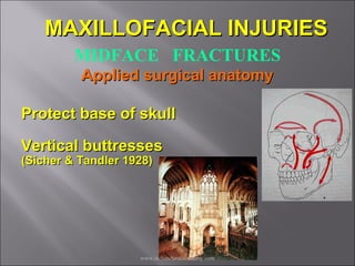 Mid face fractures / /certified fixed orthodontic courses by Indian ...