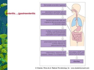 Síndrome clínica
Enteritis….(gastroenteritis)

10

 