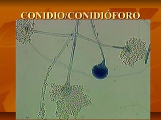 CONIDIO/CONIDIÓFORO

 