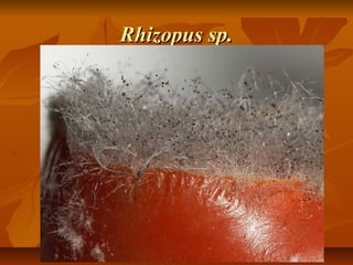 Rhizopus sp.

 