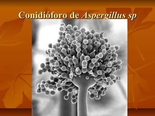 Conidióforo de Aspergillus sp

 