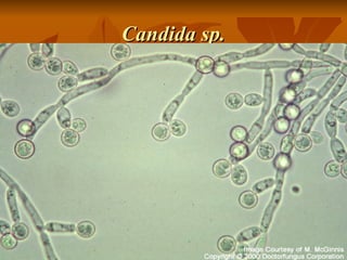Candida sp.

 