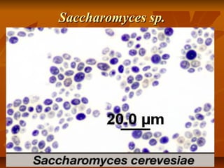 Saccharomyces sp.

 