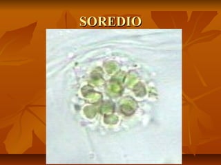 SOREDIO

 