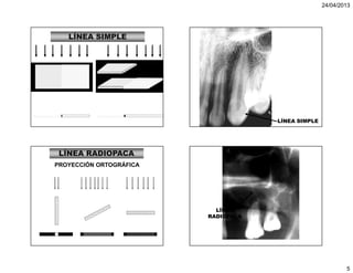 Linea Radiocava 4. imagen radiografica. formacion. calidad | PDF