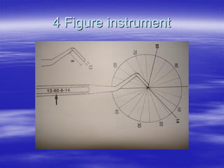 Figure Instrument general instruments & instrumentation - Restorative Dentistry | PDF