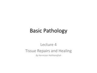 Basic Pathology
Lecture 4
Tissue Repairs and Healing
By Hermizan Halihanafiah

 