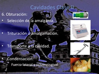 Cavidades Clase II
6. Obturación:
• Selección de la amalgama.
• Trituración o amalgamación.
• Transporte a la cavidad.
• Condensación:
– Fuerza lateral y oclusogingival

 