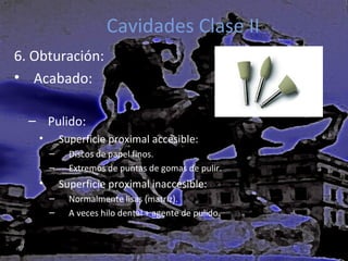 Cavidades Clase II
6. Obturación:
• Acabado:
– Pulido:
•

Superficie proximal accesible:
–
–

•

Discos de papel finos.
Extremos de puntas de gomas de pulir.

Superficie proximal inaccesible:
–
–

Normalmente lisas (matriz).
A veces hilo dental + agente de pulido.

 