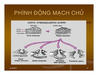 6/19/2013 11
PHÌNH ÑOÄNG MAÏCH CHUÛ
 