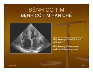 6/19/2013 128
BEÄNH CÔ TIM
BEÄNH CÔ TIM HAÏN CHEÁ
-Thickening of the LV due to
infiltration.
-Thickening of the valves
and biatrial enlargement.
 