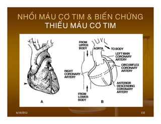 6/19/2013 133
NHOÀI MAÙU CÔ TIM & BIEÁN CHÖÙNG
THIEÁU MAÙU CÔ TIM
 