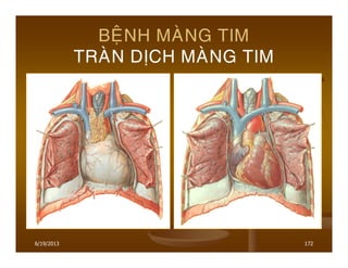 6/19/2013 172
BEÄNH MAØNG TIM
TRAØN DÒCH MAØNG TIM
 