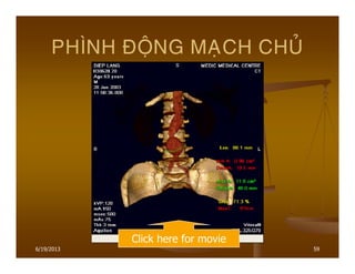 6/19/2013 59
PHÌNH ÑOÄNG MAÏCH CHUÛ
Click here for movie
 