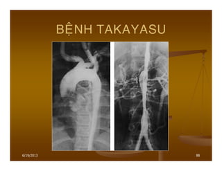 6/19/2013 88
BEÄNH TAKAYASU
 