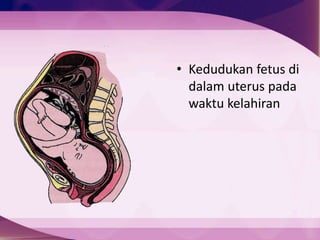 • Kedudukan fetus di
dalam uterus pada
waktu kelahiran
 