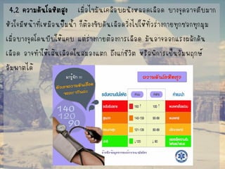 4.2 ความดันโลหิตสูง เมื่อไขมันเคลือบผนังหลอดเลือด บางจุดอาจตีบมาก 
หัวใจมีหน้าที่เหมือนปั๊มน้า ก็ต้องขับดันเลือดวิ่งไปให้ทั่วร่างกายทุกซอกทุกมุม 
เมื่อบางจุดโดนบีบให้แคบ แต่ร่างกายต้องการเลือด มันอาจออกแรงผลักดัน 
เลือด อาจทาให้เส้นเลือดในสมองแตก ถึงแก่ชีวิต หรือพิการเป็นอัมพฤกษ์ 
อัมพาตได้  