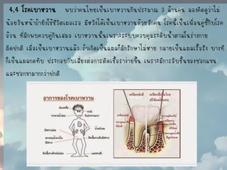 4.4 โรคเบาหวาน พบว่าคนไทยเป็นเบาหวานกันประมาณ 3 ล้านคน ลองคิดดูว่าไม่ 
น้อยวันหน้าถ้ายังใช้ชีวิตเผอเรอ มีหวังได้เป็นเบาหวานด้วยอีกคน โรคนี้เป็นเพื่อนคู่ซี้กับโรค 
อ้วน ที่มักพบควบคู่กันเสมอ เบาหวานนั้นเพราะระบบควบคุมระดับน้าตาลในร่างกาย 
ผิดปกติ เมื่อเป็นเบาหวานแล้ว ถ้าเกิดเป็นแผลก็มักรักษาไม่หาย กลายเป็นแผลเรื้อรัง บางที 
ก็เป็นแผลกดทับ ประกอบกับเสี่ยงต่อการติดเชื้อราง่ายขึ้น เพราะมีการอับชื้นของซอกแขน 
และซอกขามากกว่าปกติ  