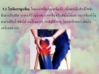 4.5 โรคข้อกระดูกเสื่อม โดยเฉพาะข้อเข่าและข้อเท้า เนื่องจากต้องรับน้าหนัก 
ตัวมากเกินพิกัด บางคนที่อ้วนมากๆ อาจจะยืนหรือเดินไม่ได้เลย เพราะข้อเท้าไม่ 
สามารถรับน้าหนักได้ คนอ้วนมากๆ จะเดินก็ลาบาก โยกเยกซ้ายขวา เดินไป 
เหนื่อยหอบไป  