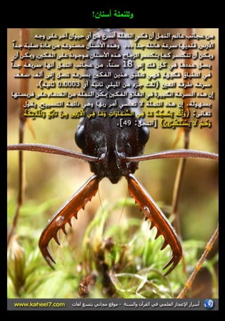 ولمنممة أسناف! 
 